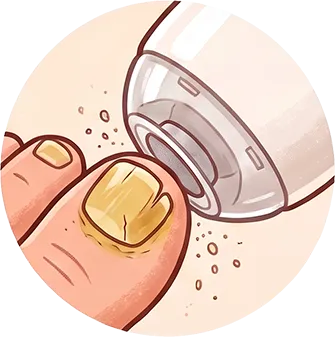Stap 2 icon